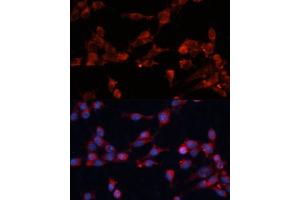 Immunofluorescence analysis of NIH-3T3 cells using eIF3B Polyclonal Antibody (ABIN6130364, ABIN6140053, ABIN6140054 and ABIN6214441) at dilution of 1:100 (40x lens). (EIF3B antibody  (AA 100-350))