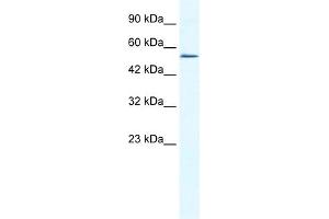 WB Suggested Anti-ZNF286 Antibody Titration:  0. (ZNF286A antibody  (N-Term))