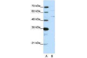Western Blot showing HNRPK antibody used at a concentration of 1-2 ug/ml to detect its target protein. (HNRNPK antibody  (N-Term))