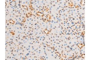 Immunohistochemistry (IHC) image for anti-Eukaryotic Translation Initiation Factor 2 Subunit 1 (EIF2S1) (pSer51) antibody (ABIN6255389)