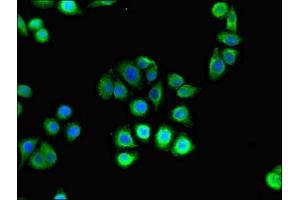Immunofluorescent analysis of PC-3 cells using ABIN7155150 at dilution of 1:100 and Alexa Fluor 488-congugated AffiniPure Goat Anti-Rabbit IgG(H+L) (Hexokinase 2 antibody  (AA 334-526))