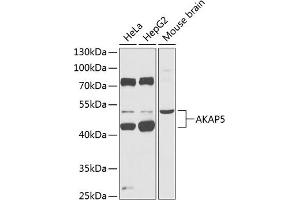 Western blot analysis of extracts of various cell lines, using  Antibody (ABIN6129178, ABIN6136707, ABIN6136709 and ABIN6218330) at 1:1000 dilution. (AKAP5 antibody  (AA 1-270))