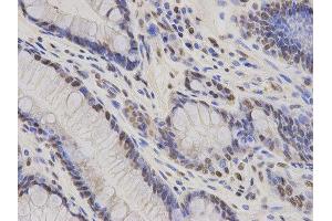 Immunohistochemistry (IHC) image for anti-Hepatoma-Derived Growth Factor (HDGF) antibody (ABIN1876535) (HDGF antibody)