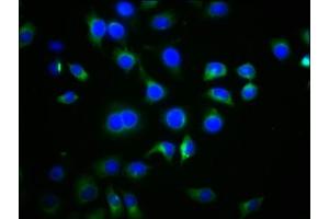 Immunofluorescence staining of A549 cells with ABIN7168752 at 1:77, counter-stained with DAPI. (DVL2 antibody  (AA 1-240))
