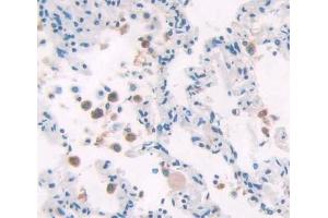 #VALUE! (POLD1 antibody  (AA 41-254))