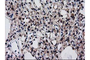 Immunohistochemistry (IHC) image for anti-Bridging Integrator 3 (BIN3) antibody (ABIN1496923) (BIN3 antibody)