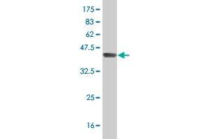 Western Blot detection against Immunogen (38. (IFT88 antibody  (AA 724-833))