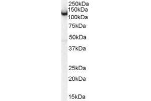 Image no. 1 for anti-Amphiphysin (AMPH) (Internal Region) antibody (ABIN374682) (Amphiphysin antibody  (Internal Region))