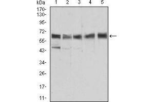 Western blot analysis using ALDH6A1 mouse mAb against Jurkat (1), HEK293 (2), Hela (3), MCF-7 (4), and LNcap (5) cell lysate. (ALDH6A1 antibody  (AA 1-195))