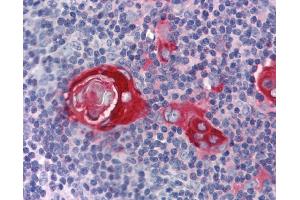 Immunohistochemistry (IHC) image for anti-Zinc Finger Protein 36, C3H Type, Homolog (Mouse) (ZFP36) (N-Term) antibody (ABIN501274) (ZFP36 antibody  (N-Term))