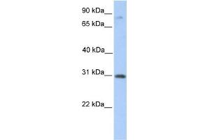 WB Suggested Anti-ABHD13 Antibody Titration:  0. (ABHD13 antibody  (C-Term))