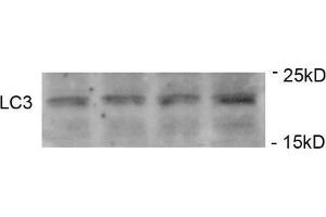 Western Blotting (WB) image for anti-Microtubule-Associated Protein 1 Light Chain 3 alpha (MAP1LC3A) (AA 1-30), (N-Term), (pSer12) antibody (ABIN1449623)