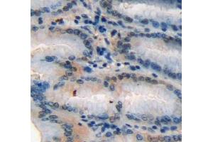 Used in DAB staining on fromalin fixed paraffin-embedded stomach tissue (SCGN antibody  (AA 1-276))
