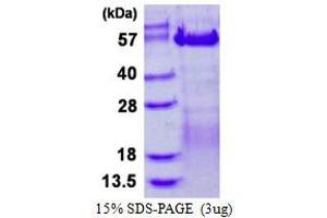 Image no. 1 for Vaccinia Related Kinase 3 (VRK3) protein (His tag) (ABIN1098635) (VRK3 Protein (His tag))