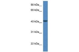 Western Blot showing CAB39L antibody used at a concentration of 1 ug/ml against COLO205 Cell Lysate
