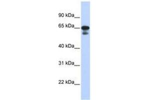Image no. 1 for anti-Histone H4 Transcription Factor (HINFP) (C-Term) antibody (ABIN6740581) (HINFP antibody  (C-Term))