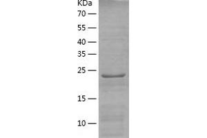Western Blotting (WB) image for RAB34, Member RAS Oncogene Family (RAB34) (AA 1-259) protein (His tag) (ABIN7124750)