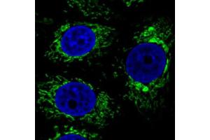Immunofluorescent staining of MCF7 cells with CS monoclonal antibody, clone CL2545  (Green) shows specific mitochondrial. (CS antibody)