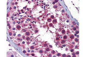 Anti-STK38 antibody IHC of human testis. (STK38 antibody  (AA 365-466))