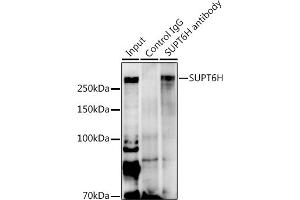 Immunoprecipitation analysis of 600 μg extracts of Mouse heart using 3 μg SUPT6H antibody (ABIN7270645). (Spt6 antibody  (AA 1500-1726))