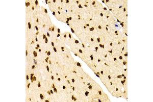 Immunohistochemistry of paraffin-embedded Mouse heart using H3K27me2 antibody at dilution of 1:100 (x400 lens). (Histone 3 antibody  (H3K27me))