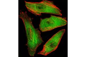 Fluorescent image of Hela cells stained with CFL2 Antibody (C-term) (ABIN6243137 and ABIN6577407). (Cofilin 2 antibody  (C-Term))