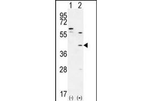 Western blot analysis of TGIF1 (arrow) using rabbit polyclonal TGIF1 Antibody (Center ) (ABIN656000 and ABIN2845379).