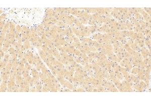 Detection of ST2 in Human Liver Tissue using Polyclonal Antibody to Syntenin 2 (ST2) (SDCBP2 antibody  (AA 1-292))