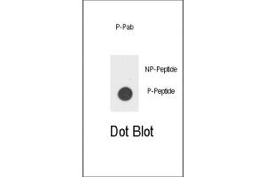 Dot Blot (DB) image for anti-Colony Stimulating Factor 2 Receptor, Beta (CSF2RB) (pTyr766) antibody (ABIN3001760) (CD131 antibody  (pTyr766))