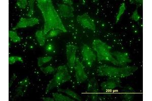 Immunofluorescence of monoclonal antibody to BGLAP on HeLa cell.