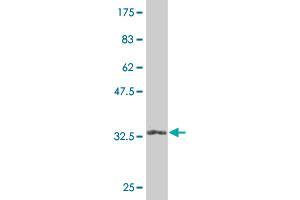 Western Blot detection against Immunogen (32. (eIF4EBP2 antibody  (AA 61-120))