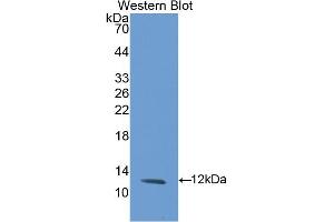 Figure. (GBA antibody  (Biotin))