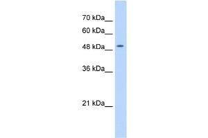WB Suggested Anti-NARG1L Antibody Titration:  1 ug/ml  Positive Control:  HepG2 cell lysate NAA16 is supported by BioGPS gene expression data to be expressed in HepG2 (NARG1L antibody  (Middle Region))