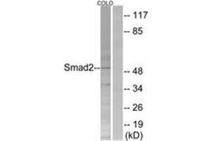 Western blot analysis of extracts from COLO205 cells, treated with serum 20% 15', using Smad2 (Ab-250) Antibody. (SMAD2 antibody  (AA 216-265))