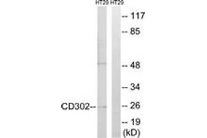 Western blot analysis of extracts from HT-29 cells, using CD302 Antibody. (DCL1 antibody  (AA 51-100))