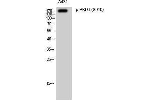 Western Blotting (WB) image for anti-Polycystic Kidney Disease 1 (Autosomal Dominant) (PKD1) (pSer910) antibody (ABIN3173025) (PKD1 antibody  (pSer910))