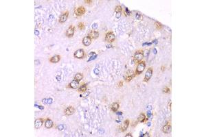 Immunohistochemistry of paraffin-embedded rat brain using RPS3A Antibody (ABIN5973489) at dilution of 1/100 (40x lens). (RPS3A antibody)