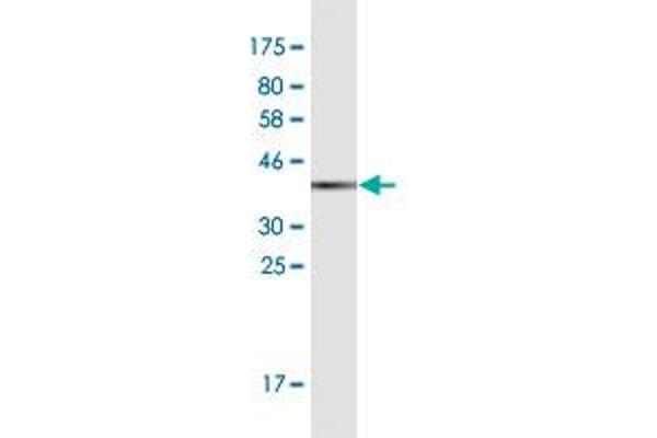 CRABP2 antibody  (AA 1-138)