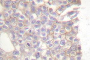 Image no. 2 for anti-BCL2-Like 11 (Apoptosis Facilitator) (BCL2L11) antibody (ABIN265330) (BIM antibody)