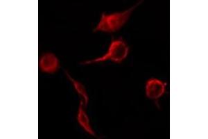 ABIN6276507 staining RAW264. (TNFRSF1B antibody  (C-Term))