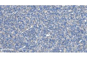 IHC analysis of DRP1/DNM1L using anti-DRP1/DNM1L antibody (ABIN7602180).