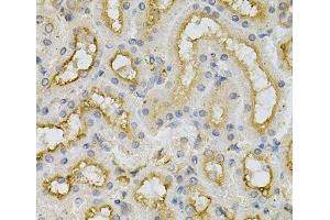 Immunohistochemistry of paraffin-embedded Mouse kidney using FHL1 Polyclonal Antibody at dilution of 1:100 (40x lens). (FHL1 antibody)