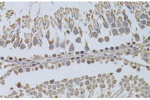 Immunohistochemistry of paraffin-embedded Rat testis using P2RY2 Polyclonal Antibody at dilution of 1:100 (40x lens). (P2RY2 antibody)