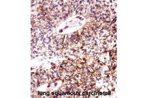 Immunohistochemistry (IHC) image for anti-Epithelial Cell Transforming Sequence 2 Oncogene (ECT2) antibody (ABIN2998212)
