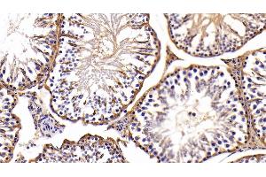 Immunohistochemistry (IHC) image for anti-Lactate Dehydrogenase B (LDHB) (AA 1-334) antibody (ABIN7433966)