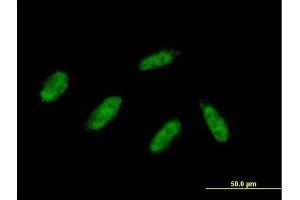 Immunofluorescence of purified MaxPab antibody to ZMYND11 on HepG2 cell. (ZMYND11 antibody  (AA 1-508))