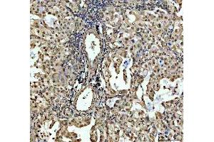 IHC analysis of SP6 using anti-SP6 antibody (ABIN5692945). (SP6 antibody)