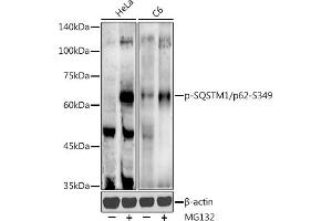 Western blot analysis of extracts of various cell lines, using Phospho-SQSTM1/p62-S349 antibody (ABIN7270206) at 1:500 dilution. (SQSTM1 antibody  (pSer349))