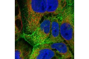 Immunofluorescent staining of CACO-2 with VIL1 polyclonal antibody  (Green) shows positivity in plasma membrane and nucleus but excluded from the nucleoli.