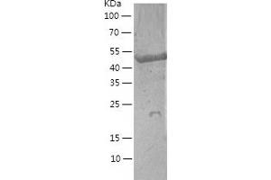 Western Blotting (WB) image for FK506 Binding Protein 5 (FKBP5) (AA 1-457) protein (His tag) (ABIN7287104) (FKBP5 Protein (AA 1-457) (His tag))